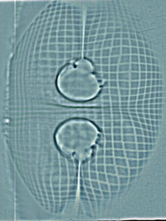 Proton Radiograph